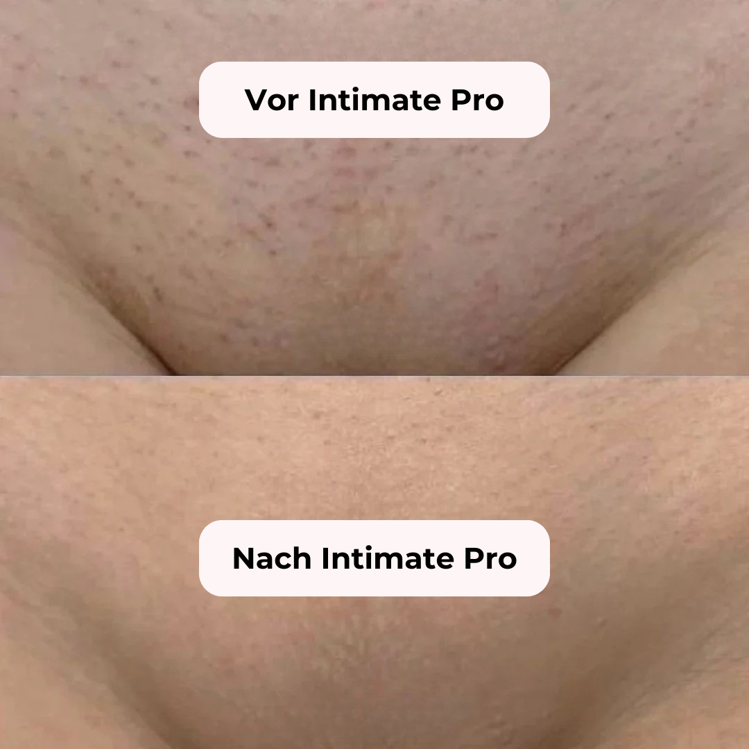 Vintara Intimate Pro 2-in-1