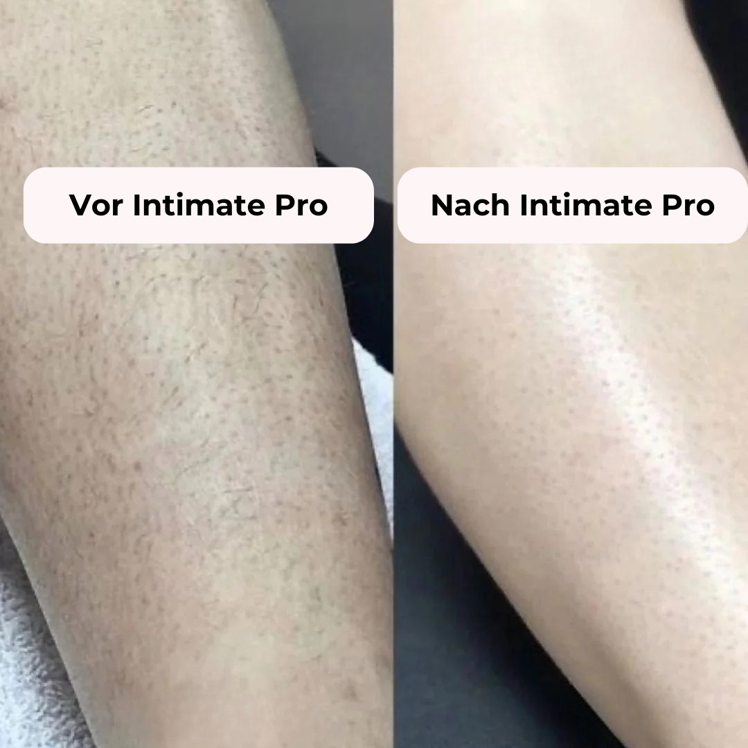 Vintara Intimate Pro 2-in-1