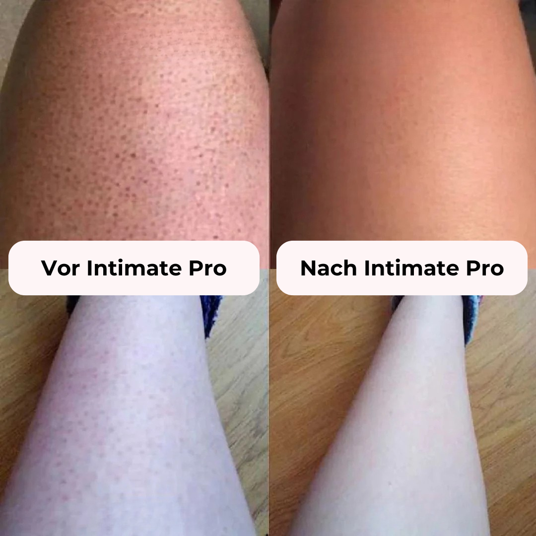 Vintara Intimate Pro 2-in-1